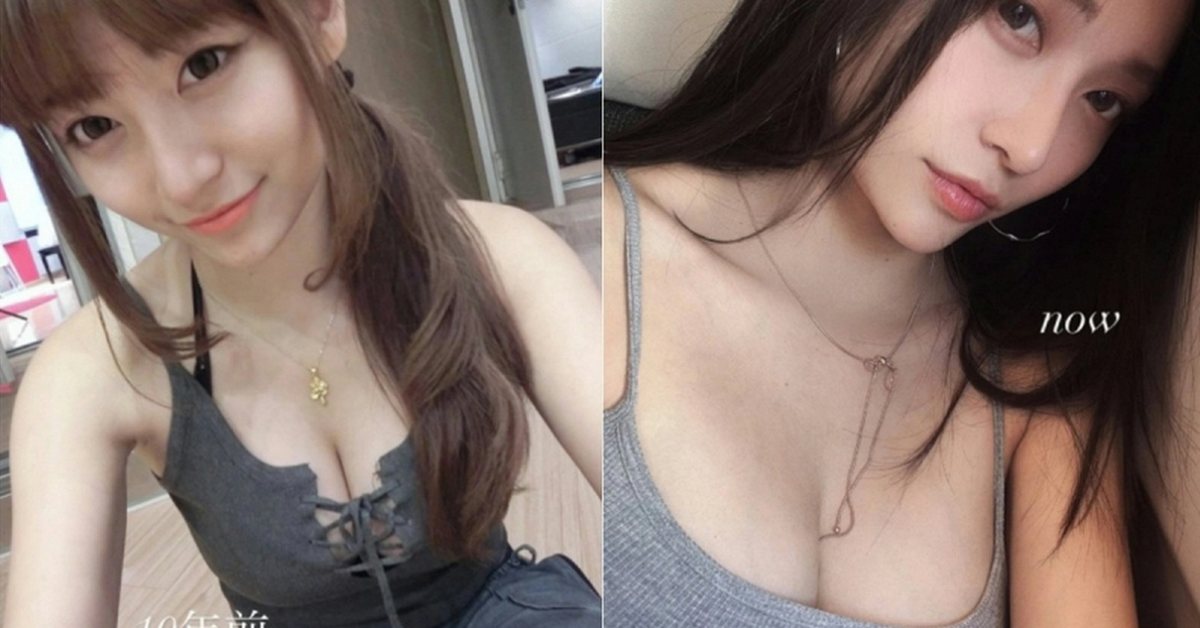 Bị đồn thẩm mỹ “dao kéo” vòng một, hot girl nổi tiếng bức xúc tung bằng chứng phản pháo