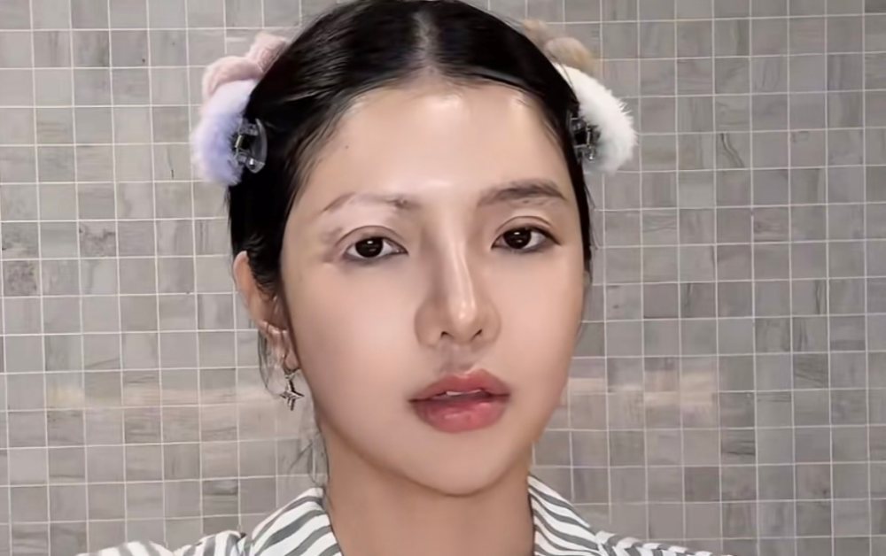 Mỹ nhân Việt mắc bệnh hiếm chỉ 2% dân số gặp phải, nhan sắc gây chú ý