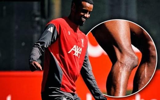 Hình ảnh đầu gối biến dạng của Isak gây sốc, fan Liverpool lo ngại về “bom tấn” 100 triệu bảng